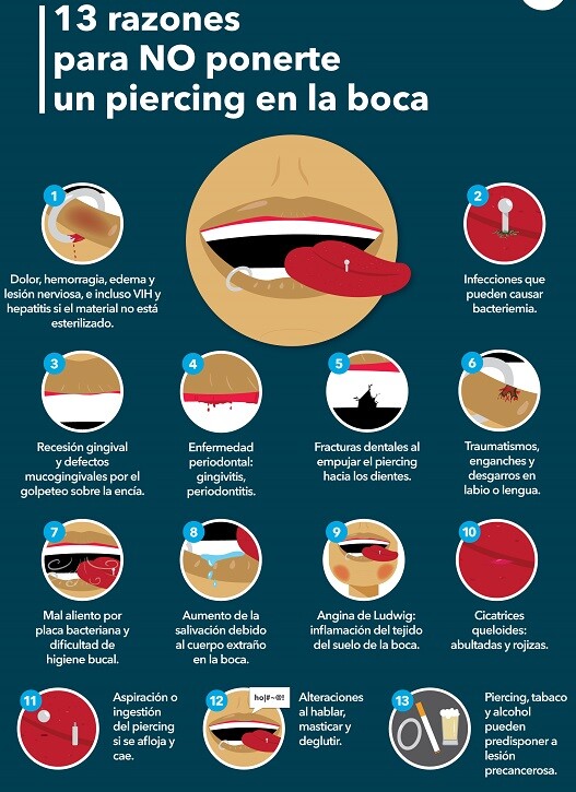 Piercing oral (infografía). Dra. Gloria Calsina Gomis