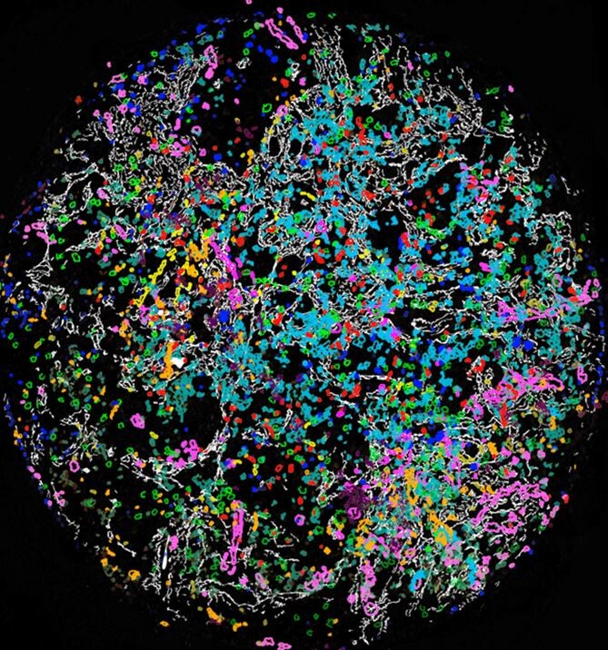 2016-08 Tumor