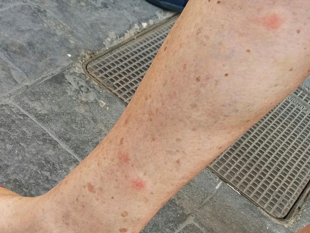 mosquitos-en-mislata-2