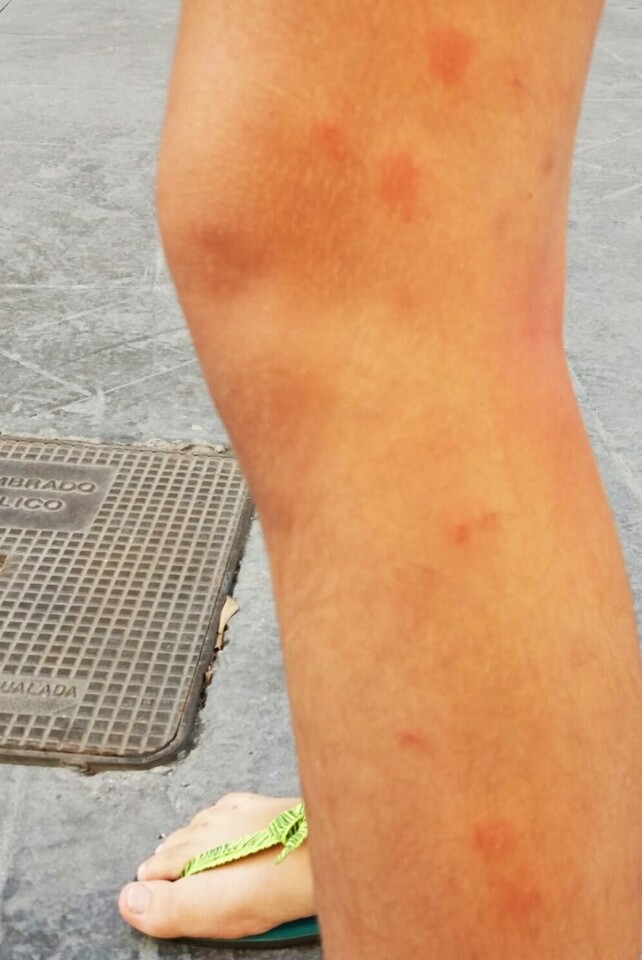 mosquitos-en-mislata