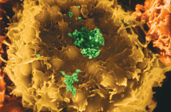 Imagen microscópica del virus HTLV-1 (verde) infectando un linfocito T humano (amarillo). / Enciclopedia Británica-Dennis Kunkel/Phototake