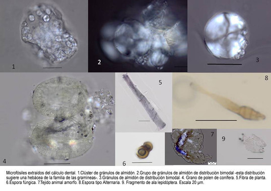 Los microfósiles identificados en la mandíbula de Atapuerca. / Karen Hardy