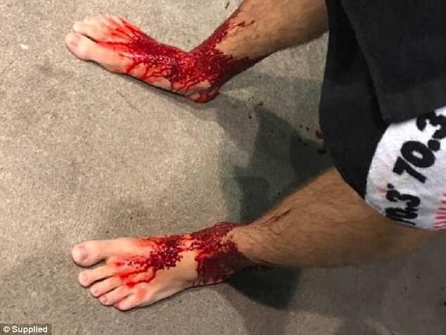 PIES-SANGRE-11
